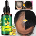 Hair growth, ginger, hair, nutrient solution, solidification, hair removal, anti-hair removal products